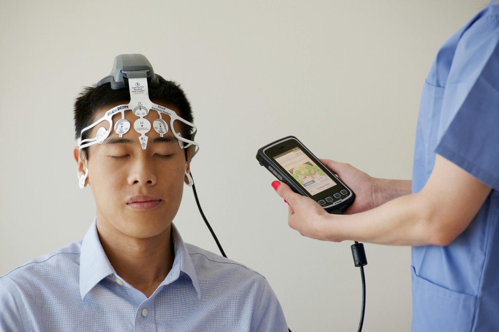 Estimulación Magnética Transcraneal en la Depresión